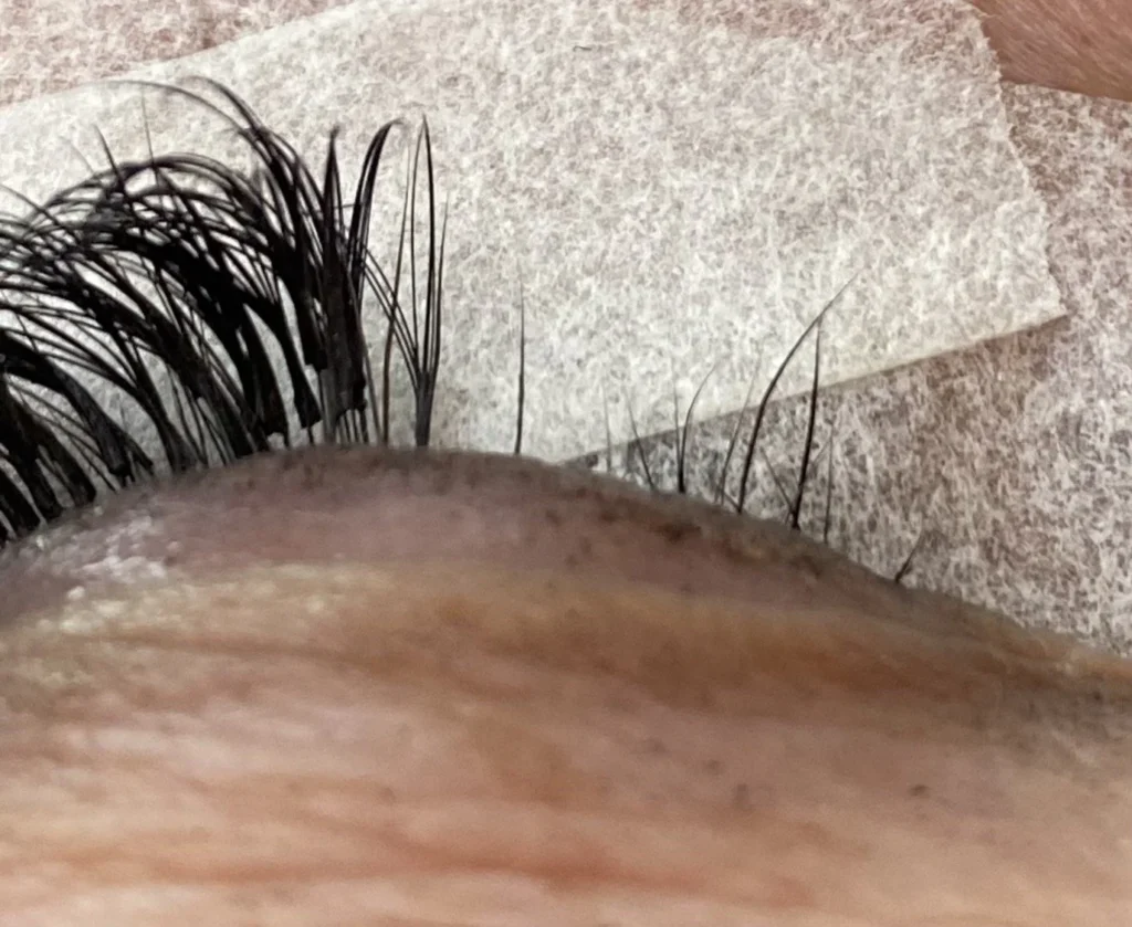 Close-up photo of damaged natural eyelashes with sparse growth after improper lash extension removal.